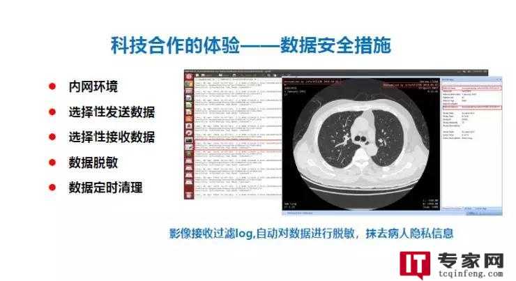 肺结节如何通过AI识别？